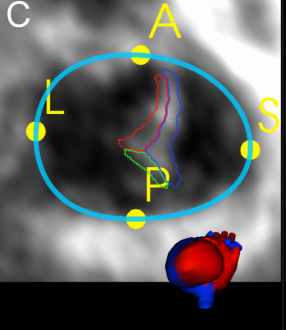 Pasted image 20250820232241.png